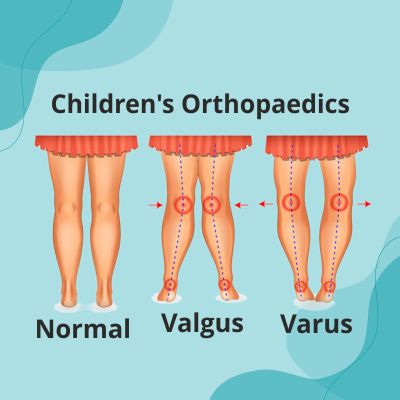 https://drkarthikgudaru.com/wp-content/uploads/2022/02/Paediatric-Orthopaedic-_-2.png